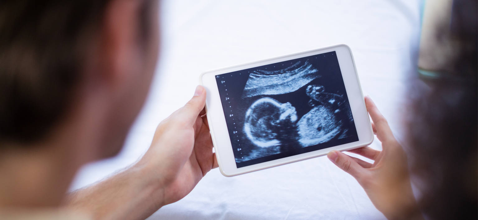 Ultrasonido 4d Ver el rostro y la anatomía del bebé con nitidez y claridad