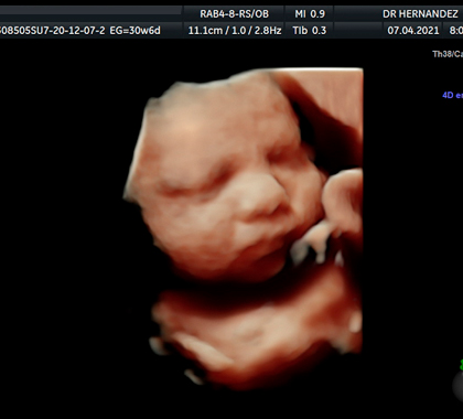 Ultrasonido rostro embarazo cara bebé